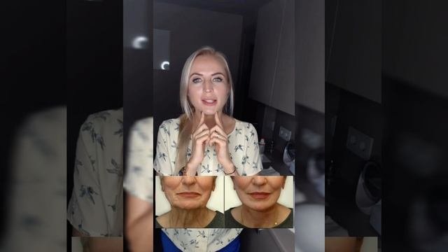 Увеличиваем подбородок филлером