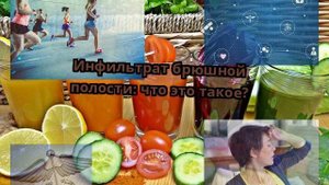 Инфильтрат брюшной полости: что это такое?