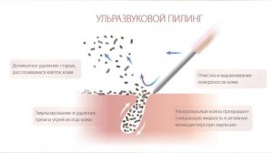 УЛЬТРАЗВУКОВАЯ ЧИСТКА ЛИЦА ? DOCTOR COMFORT US-4