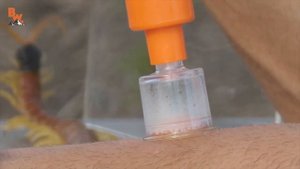 УДАЛЯЕМ ЯД СКОЛОПЕНДРЫ / ПОСЛЕДСТВИЯ УКУСА / Койот Питерсон на русском