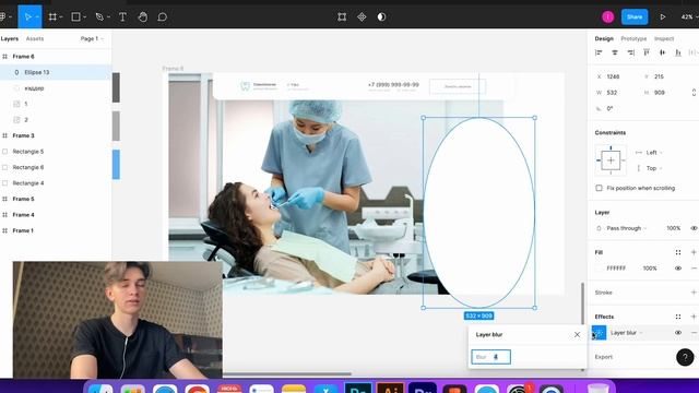Дизайн ДО / ПОСЛЕ в ФИГМЕ для СТОМАТОЛОГИИ / Обновил экран лендинга смотреть онлайн