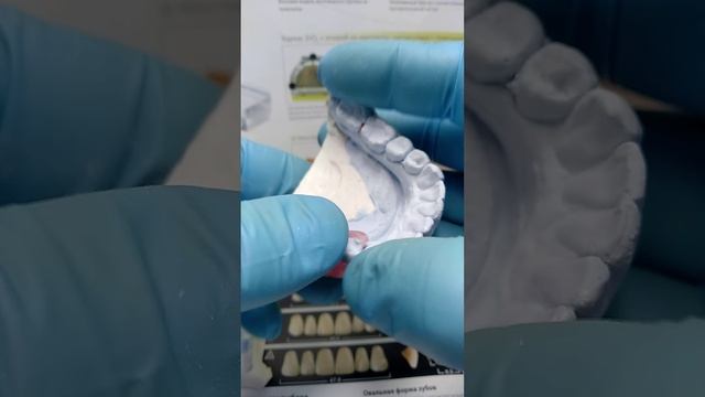 Нейлоновый протез смотреть онлайн