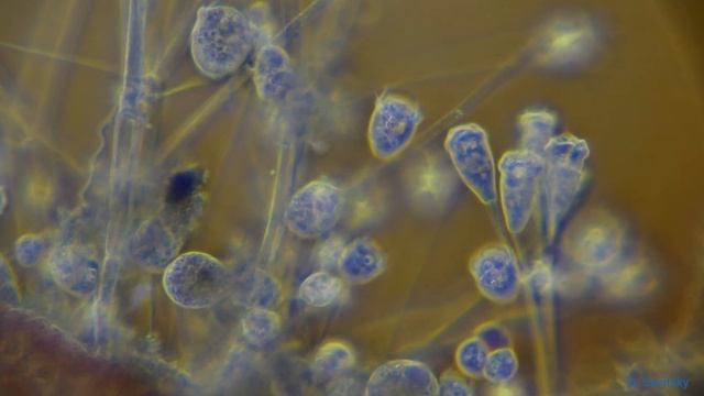 Сидячие инфузории. Циркулярное освещение \Ciliates of the Sessilida order. Circular oblique lightin смотреть онлайн