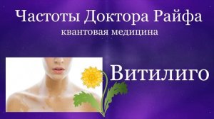 Витилиго - Частоты Доктора Райфа - Помощь в Лечении - Звуки Исцеления