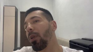 Использую миноксидил больше года. Показываю результат.