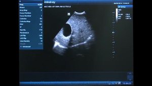 УЗИ АППАРАТ MINDRAY DP-50