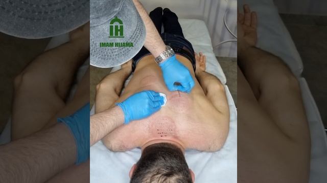 Хиджама в Краснодаре смотреть онлайн