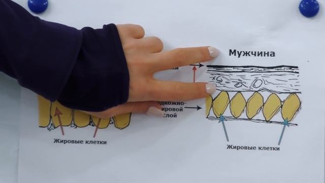 Вакуум. Целлюлит. Внутренний семинар по просьбам подписчиков.