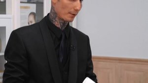 Диодный лазер SHR BL1. Преимущества.