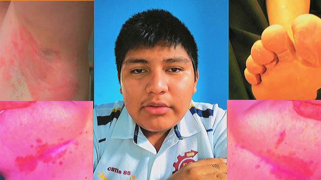 3CLV SALAS ORLANDO BACTERIA Corynebacterium minutissimum (ETIM) смотреть онлайн