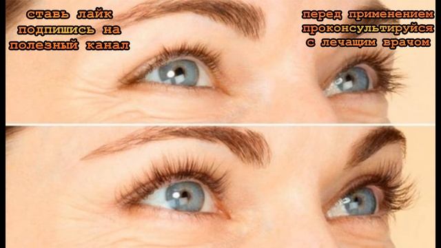 ★ Гель из алое и касторового масла для красивых ресниц. Наносить на веки на всю ночь смотреть онлайн