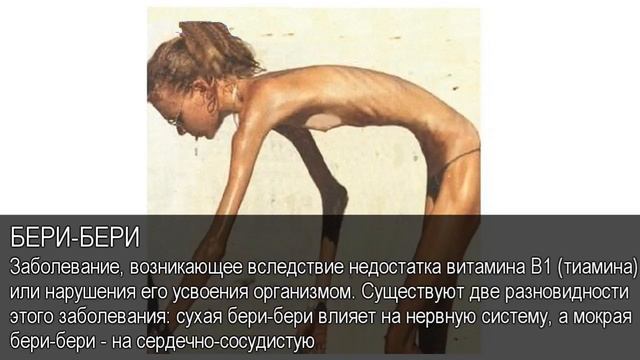 Бери-бери. Толковый Видеословарь русского языка