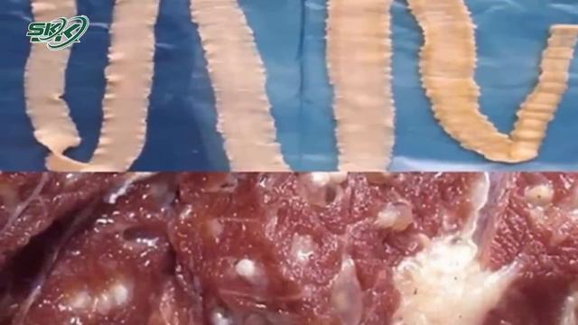 Bản Tin Y Tế 21/2: Kinh Hoàng: Cô Gái Bị Máy Kéo Sợi Lột Toàn Bộ Da Đầu, Lộ Xương Sọ | SKĐS смотреть онлайн