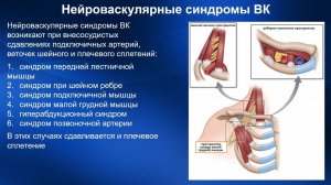 2.33. Массаж при нейроваскулярных синдромах верхних конечностей | Медицинский массаж. Цикл 2