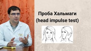 Проба Хальмаги (head impulse test)