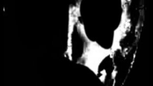 Mr Incredible becoming Uncanny Phases (1-50) (2-100) at the same time