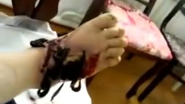 Пиявки на стражи здоровья часть 1 смотреть онлайн