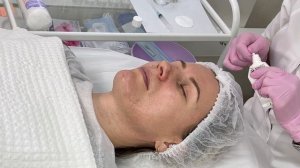 Пилинг для лица