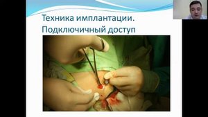 Опыт применения внутривенных порт-систем в онкологии