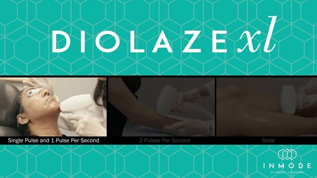 DiolazeXL смотреть онлайн