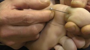 Иголка в палец. С понтом типа фотошоп