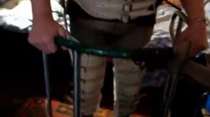 Ортезирование при миелопатии  ХКЭПОП