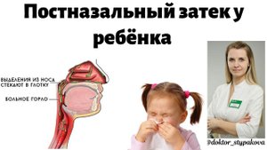 Постназальный затек у детей .Как отличить синдром постназального заката от инфекционного кашля?