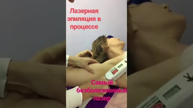 Лазерная эпиляция подмышек