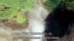 Прилипающие адгезивные зубные протезы  — Статья