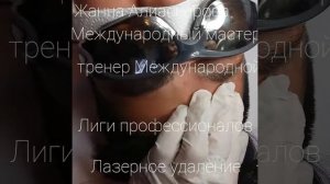 Лазерное удаление татуажа бровей . Мужчины тоже делают это .