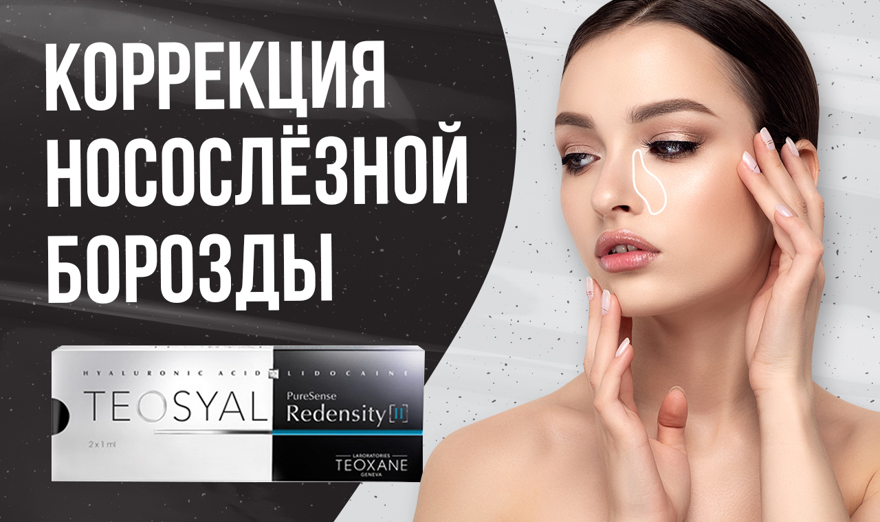 Коррекция носослезной борозды