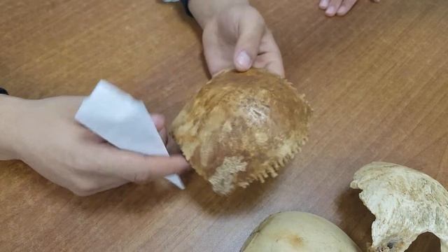 Теменная кость ( Os parietale ) смотреть онлайн