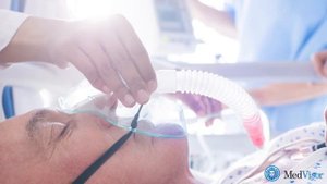 СИНДРОМ ГИЙЕНА-БАРРЕ