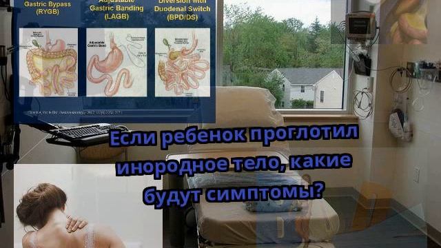Если ребенок проглотил инородное тело, какие будут симптомы?