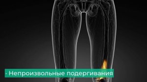 Сделай это и забудь про синдром беспокойных ног навсегда!