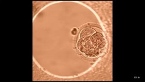 Развитие эмбриона с момента оплодотворения in vitro и до 5 6 дня развития реальное видео 1