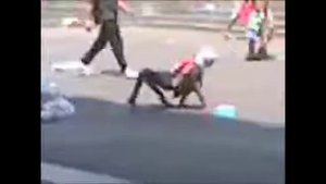 В Индии женщина, с мутацией ног.