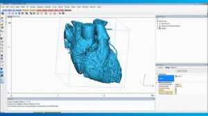 How to Create a Heart Model for 3D Printing |  Mimics Innovation Suite | Materialise Medical