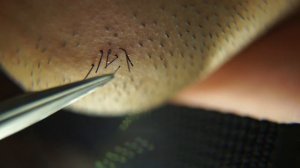 Удаление нежелательных волос на подбородке FHD l Пинцет Борода l 2021/10/24