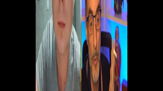 Дядя Слава и чесотка в рулетки
