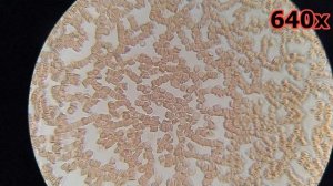 Кровь после ВОДОРОДной воды