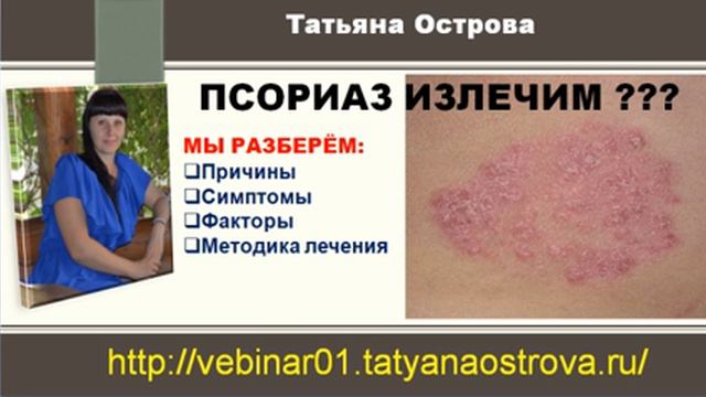 Татьяна Острова Псориаз излечим