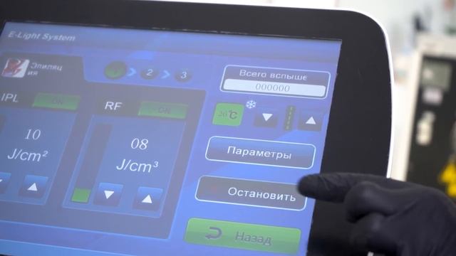 Огляд апарату ELOS епіляції та фотоомолодження Adonyss QuantumPeak смотреть онлайн