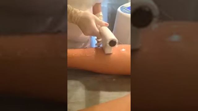 Полный отзыв о фотоэпиляции NoMoreHair смотреть онлайн