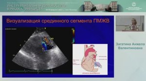 Ультразвуковое исследование коронарных артерий в клинической практике