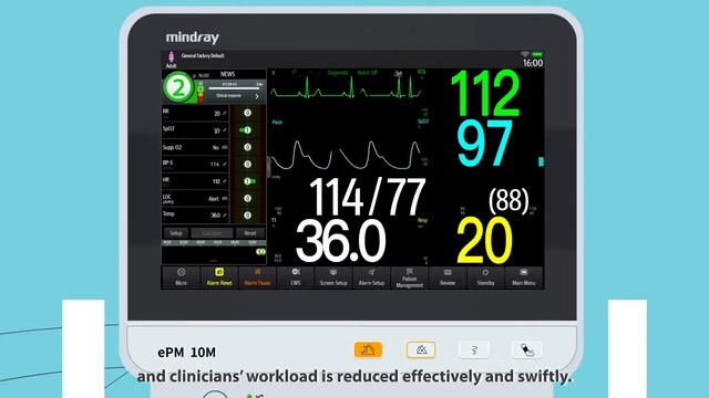 How does the EWS tool works in ePM Series patient monitors? смотреть онлайн