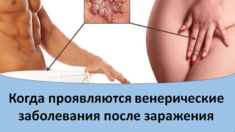 Когда проявляются венерические заболевания после заражения.