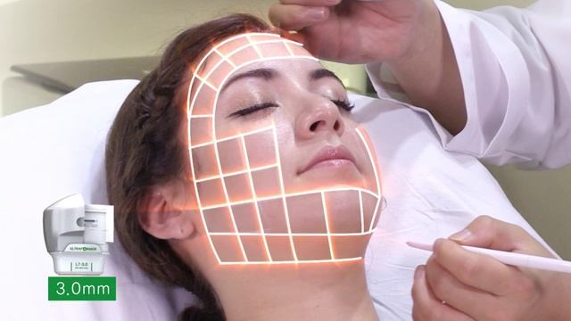 005_ULTRAFORMER.mp4