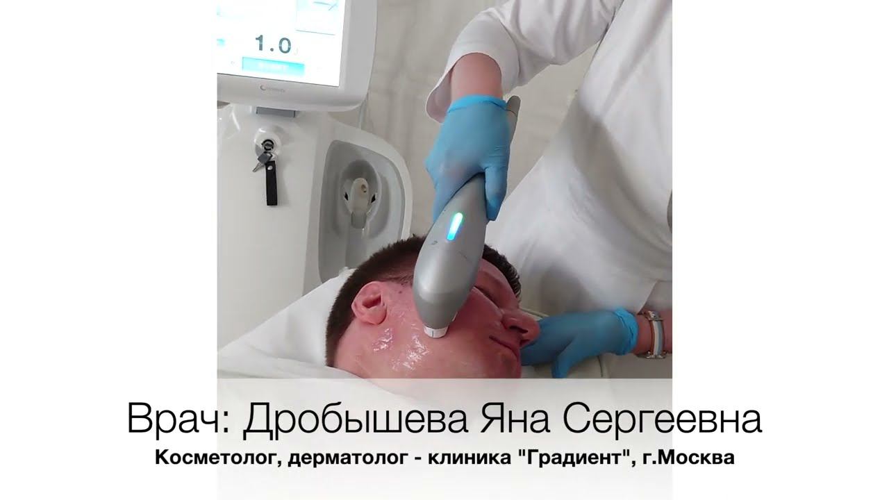 Коррекция овала лица: ULTRAFORMER III и инъекции