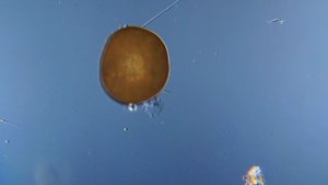 Панцирная амеба под микроскопом